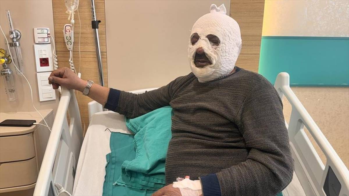 Kalorifer kazanını yakmak i&ccedil;in d&ouml;kt&uuml;ğ&uuml; benzin az daha canından ediyordu