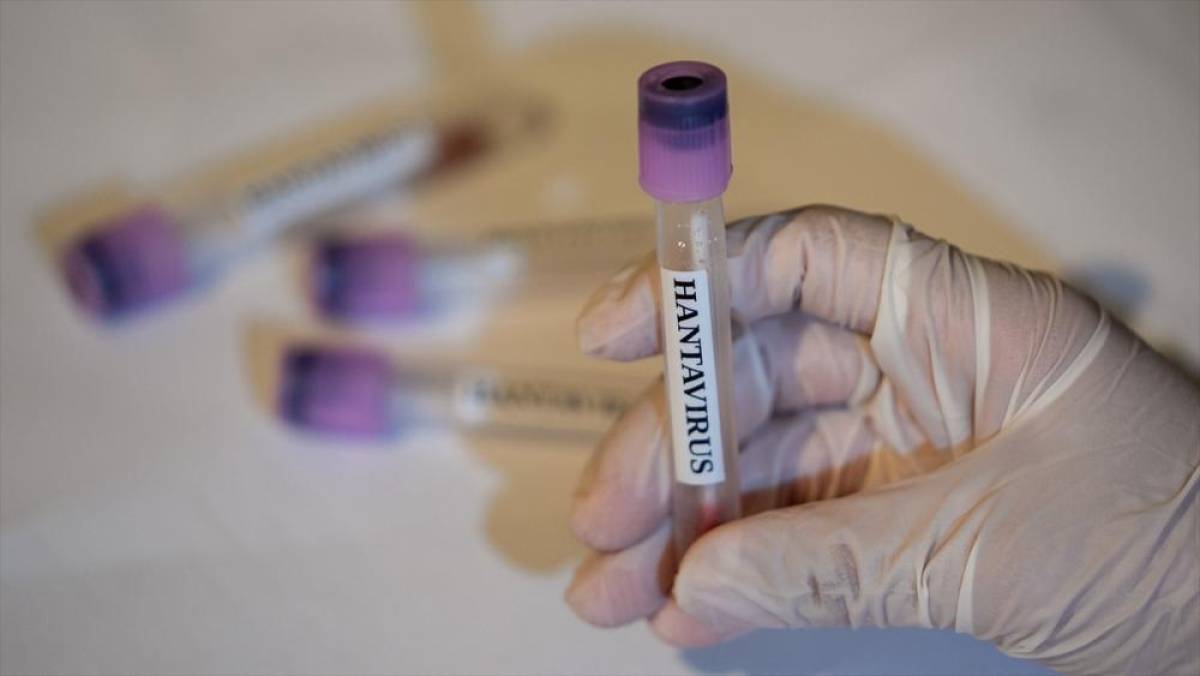 Avrupa İla&ccedil; Ajansı: Hantavir&uuml;s i&ccedil;in onaylı tedavi ve aşı yok