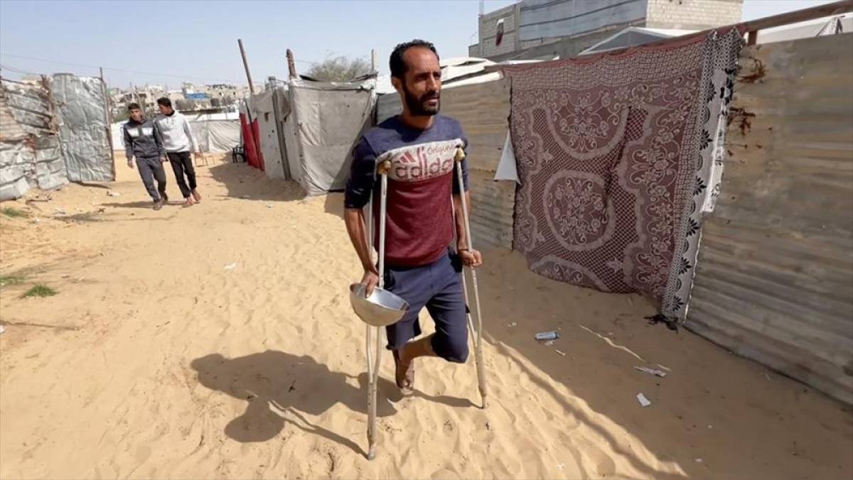 İsrail saldırısında bacağını kaybeden Gazzeli baba engeline rağmen ailesi i&ccedil;in m&uuml;cadelesini s&uuml;rd&uuml;r&uuml;yor