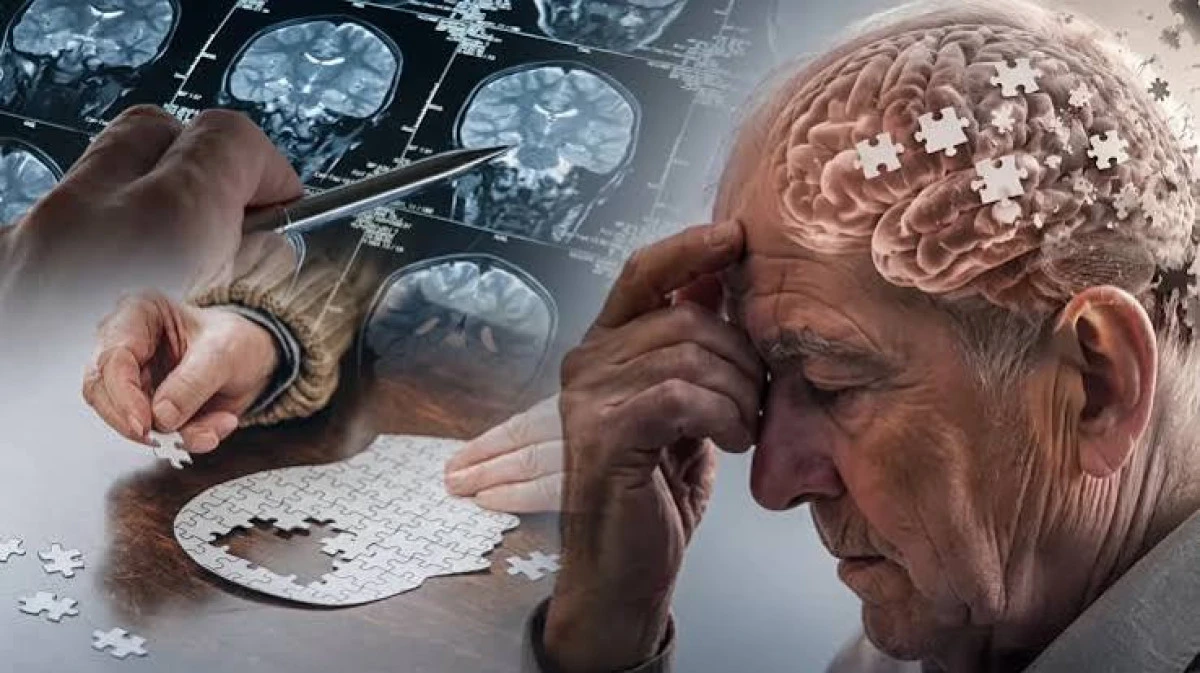 Alzheimer uyarısı: 'T&uuml;rkiye'de en &ouml;nemli sağlık sorunlarından biri olabilir'